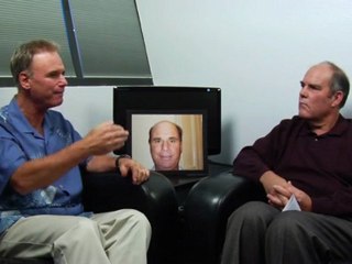 Hair Loss solutions for men - what will people think?