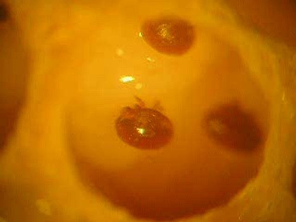 Varroa_destructor.wmv