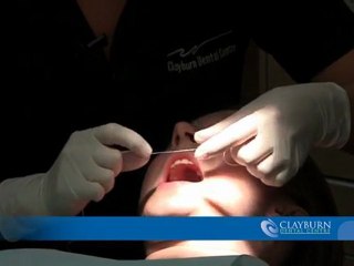 Abbotsford dentist: How to floss properly