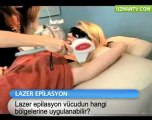 Lazer epilasyon vücudun hangi bölgelerine yapılabilir