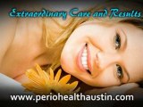 Dental Implants Austin TX | 78746 Dentist | Teeth Care Austin TX