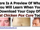 treatment for chicken pox - chicken pox during pregnancy - fast chicken pox cure