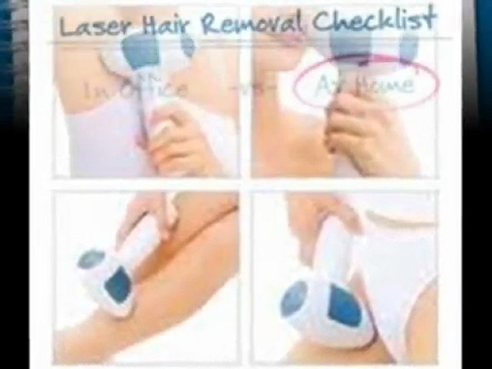 Tria Laser Hair Removal System
