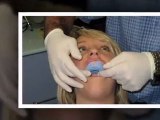 Teeth Whitening Gurnee IL - Tooth Bleaching Gurnee IL - Gurnee IL Cosmetic Dentist