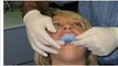 Teeth Whitening Lake Forest IL - Tooth Bleaching Lake Forest IL - Lake Forest IL Cosmetic Dentist