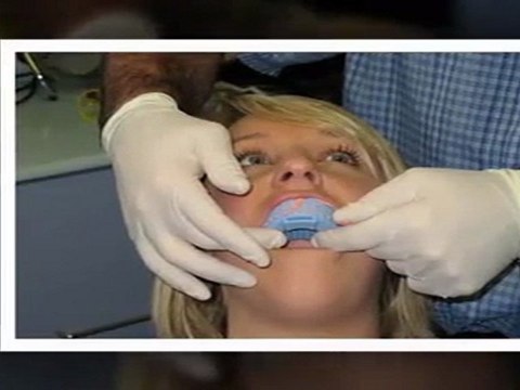 Teeth Whitening Lake Forest IL - Tooth Bleaching Lake Forest IL - Lake Forest IL Cosmetic Dentist