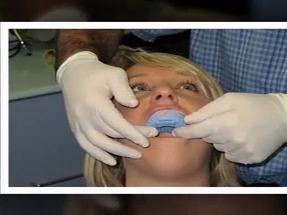 Teeth Whitening Lake Forest IL - Tooth Bleaching Lake Forest IL - Lake Forest IL Cosmetic Dentist