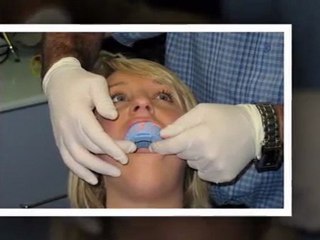 Teeth Whitening Lindenhurst IL - Tooth Bleaching Lindenhurst IL - Lindenhurst IL Cosmetic Dentist