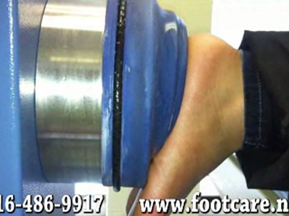 Extracorporeal Shock Wave Therapy - Podiatrist Toronto, ON