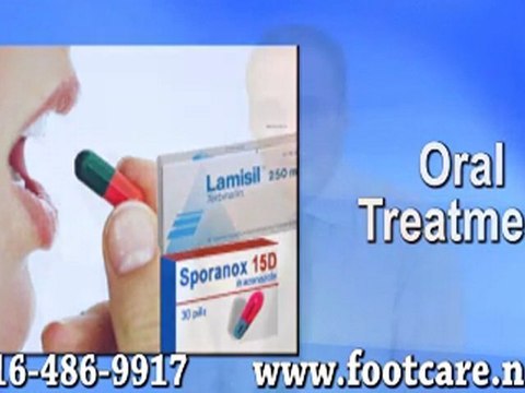 Fungal Toenails - Podiatrist Toronto, ON