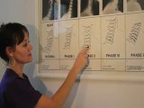 How our spine degenerates over time - Chiropractor ...