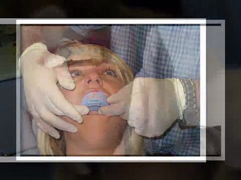 Teeth Whitening Round Lake Beach IL - Tooth Bleaching Round Lake Beach IL - Round Lake Beach IL Cosmetic Dentist