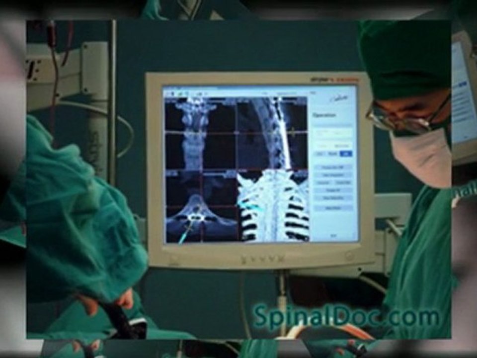 Spinal Surgery