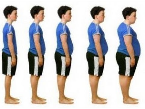 Napoli - Arriva MangiaFelix contro l'obesità infantile