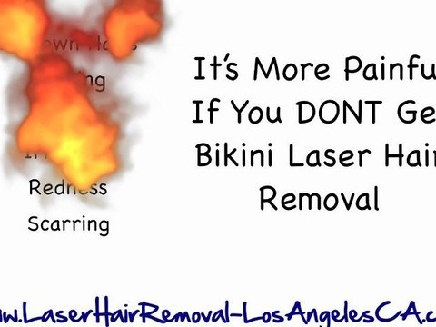 LA Laser Hair Removal in Los Angeles CA