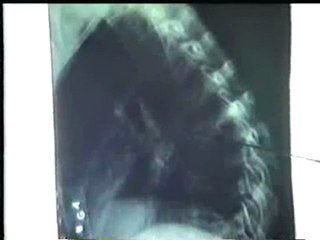 benhvathuoc.com Bệnh lao xương khớp