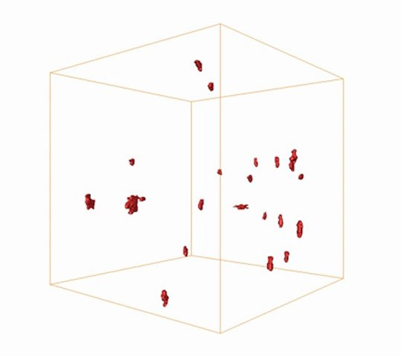 Fracture-EMaire