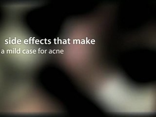 Acne Spot Treatment- Different Product Lines