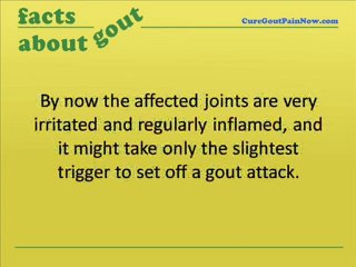 What Is Chronic Gout