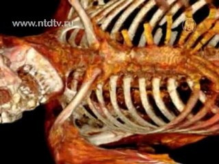 Увидеть мумию изнутри смогли американцы