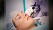 Laser Acne Scar Removal - How To Avail Of The Single Most Effective Acne Treatment