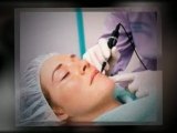 Laser Acne Scar Removal - How To Avail Of The Single Most Effective Acne Treatment
