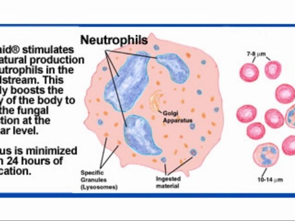 Molluscum contagiosum, Treating it the Natural Way.