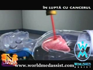 Cyberknife radiation treatment at Anadolu Medical ...