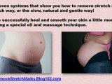 stretch mark remedies - stretch mark treatments