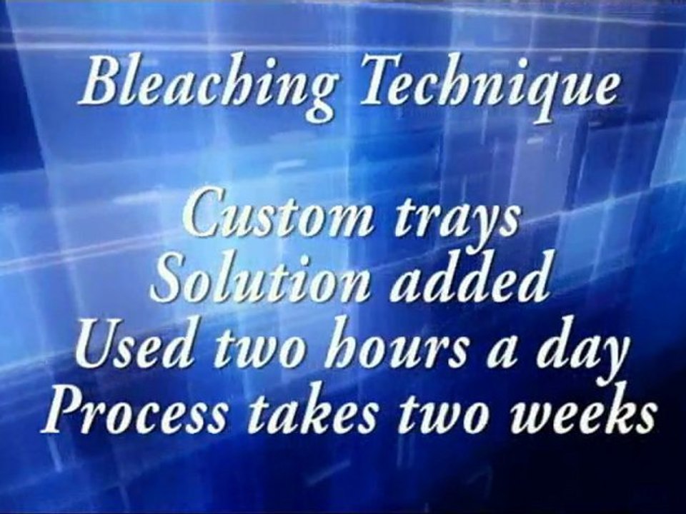 Virginia Beach Teeth Whitening