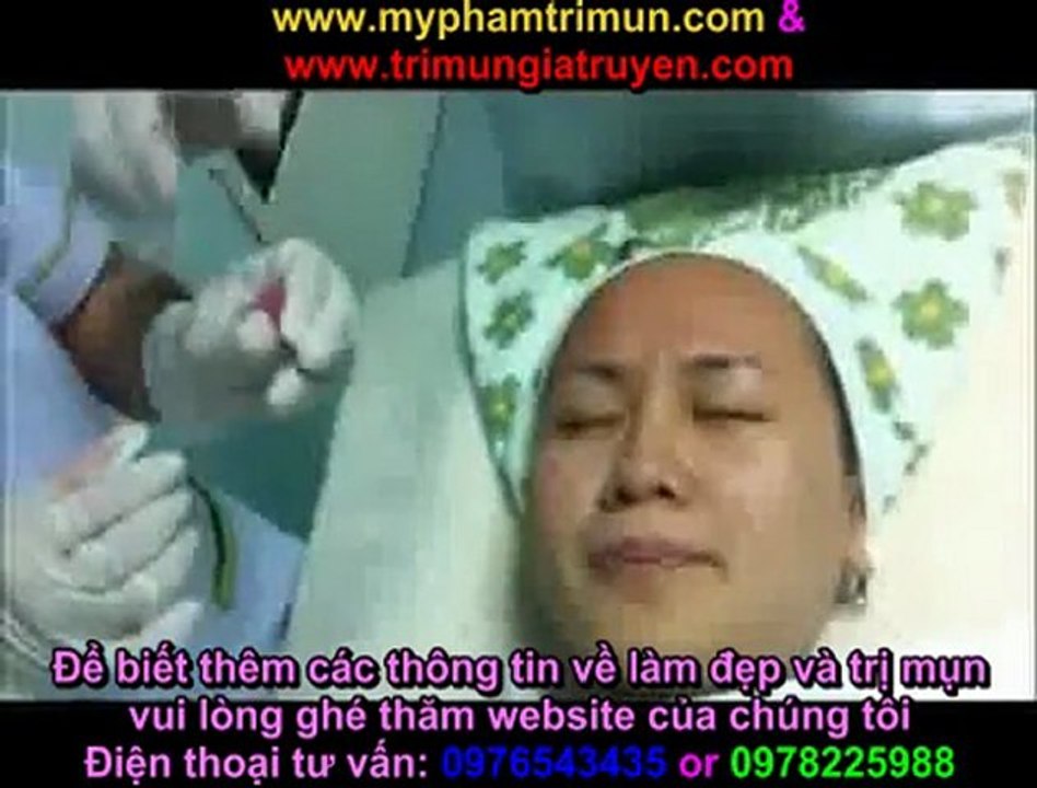 Công Nghệ Tế Bào Gốc Phương pháp lăn kim