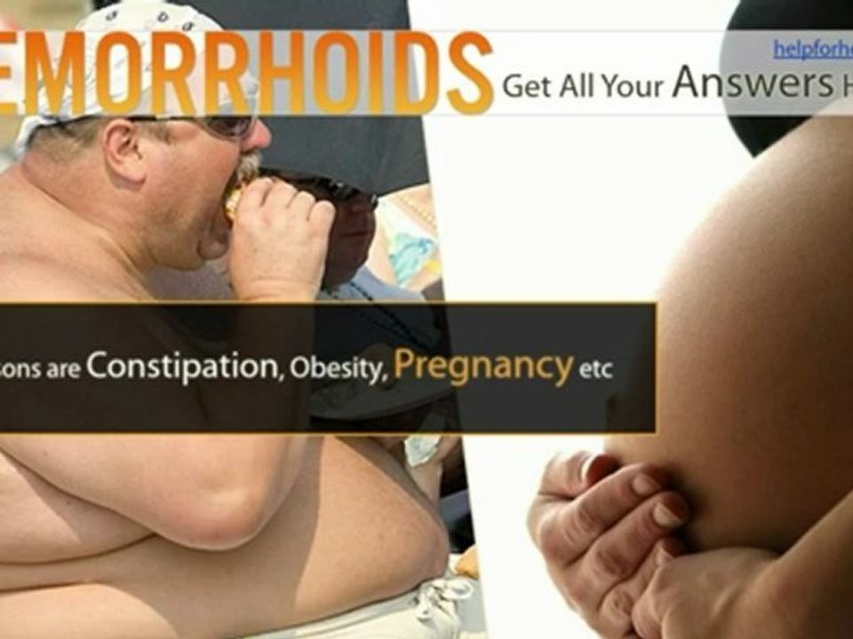 Hemorrhoids – Get All Your Answers Here