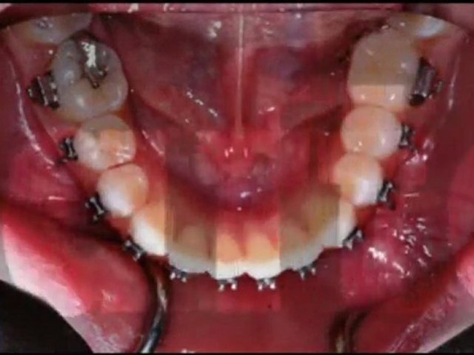 Orthodontist South Austin – Dr. Moody is an Orthodontic Specialist in Austin TX!