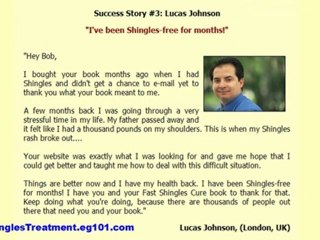 shingles pain relief - shingles without rash - treatment of shingles