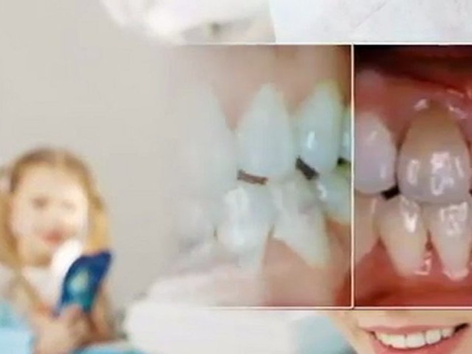 Orthodontist & Trusted cosmetic dentistry in Hawthorne, CA