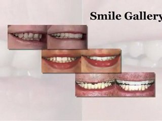 Experienced and skilled cosmetic dentist in VA