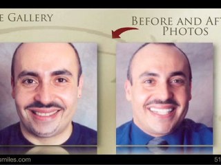 General & Cosmetic Dentistry Garden City, NY - Dr. Louis Buono