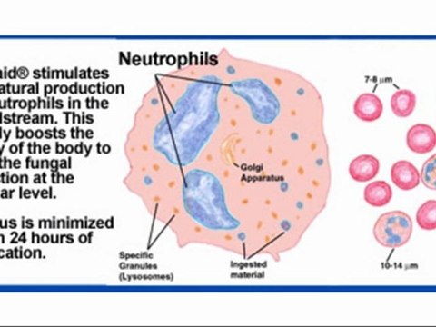 Healing Cellulitis Infection Without Drugs.