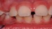 Cherry Hill NJ Braces - Dr Amy James - Voorhees NJ Braces