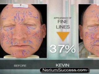 Nerium Opportunity, Nerium Review, Nerium Skin (Nerium International)