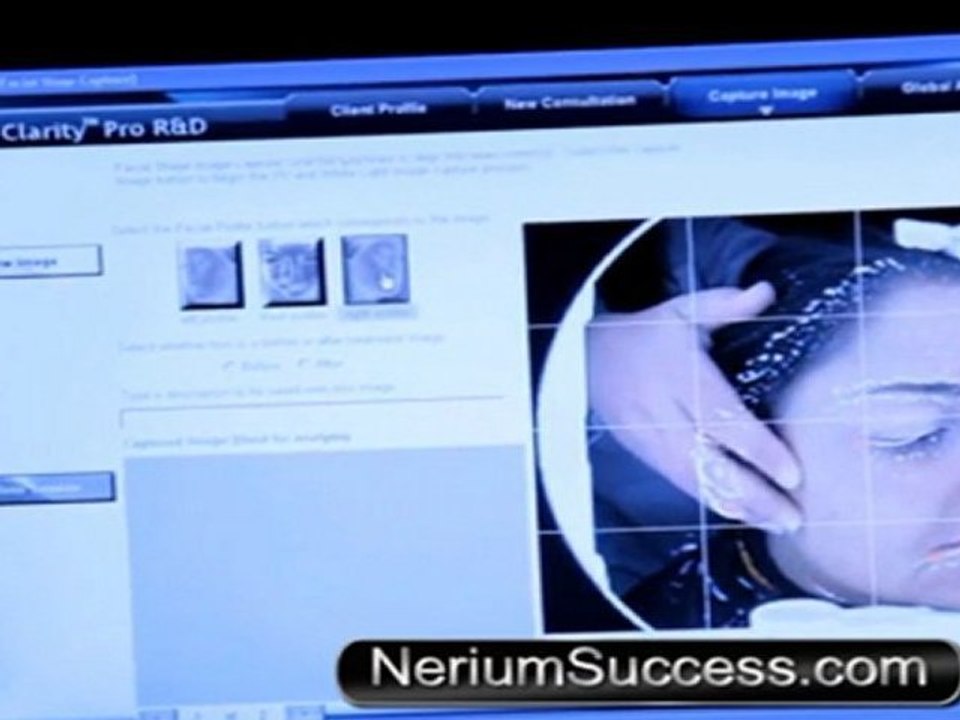 Nerium Results Nerium Reviews (Nerium International Skincare)