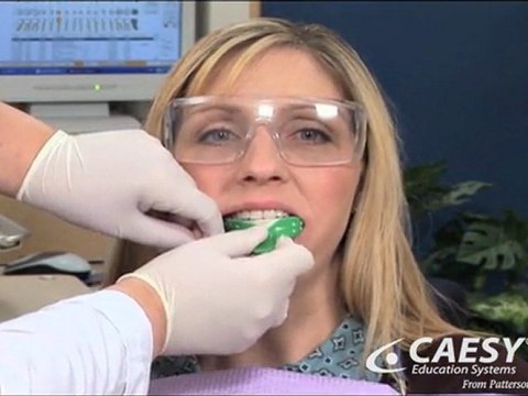 Permanent Teeth Whitening Langhorne, Philadelphia, Newtown