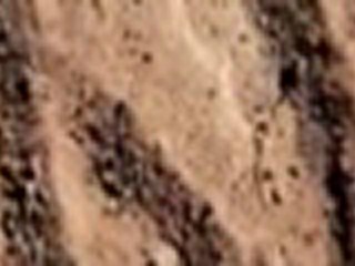 How To Get Rid Of Dry Skin On Face