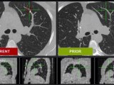 Radiology imaging breakthrough helps radiologists diagnose faster