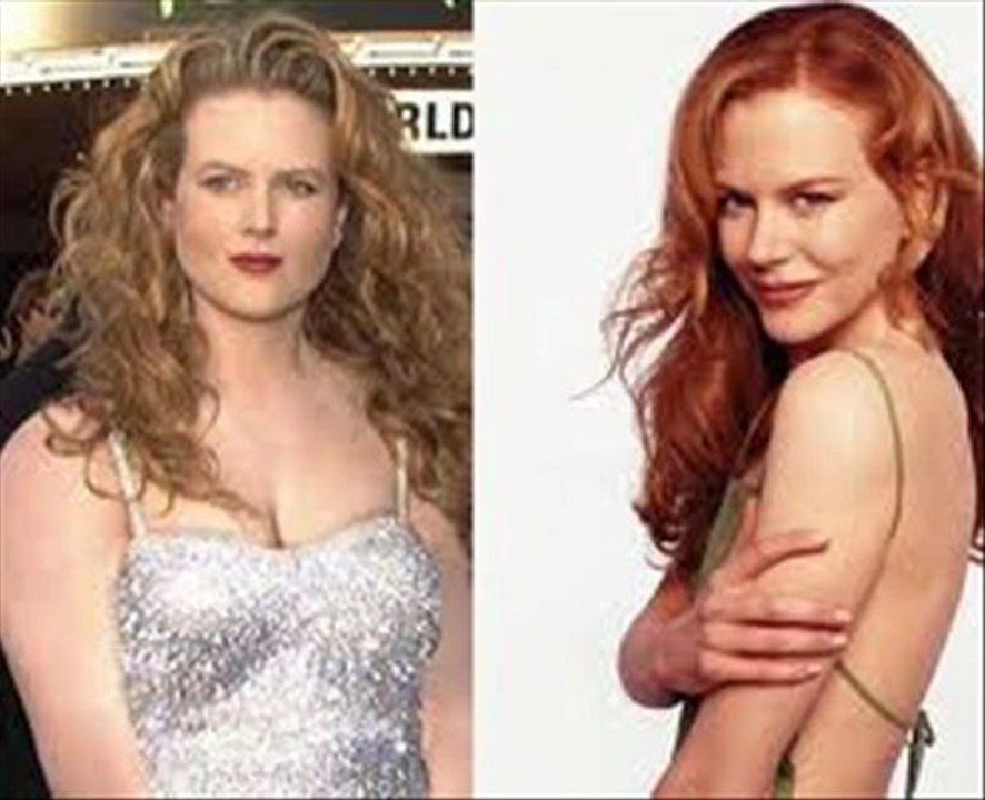 fast weight loss