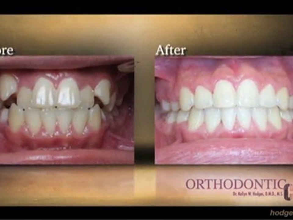 Orthodontist in Bala Cynwyd, Bensalem & Montgomeryville, PA