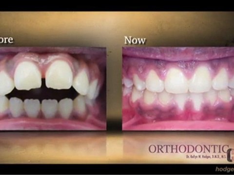Orthodontics Bala Cynwyd, Bensalem and Montgomeryville
