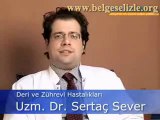 Sedef Hastalığı Nedir?