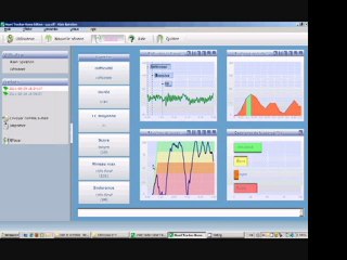 Cohérence cardiaque -5- Installer une image de rétroaction