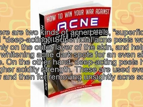 An Introduction To Acne Cure Secret Of Chemical Peels
